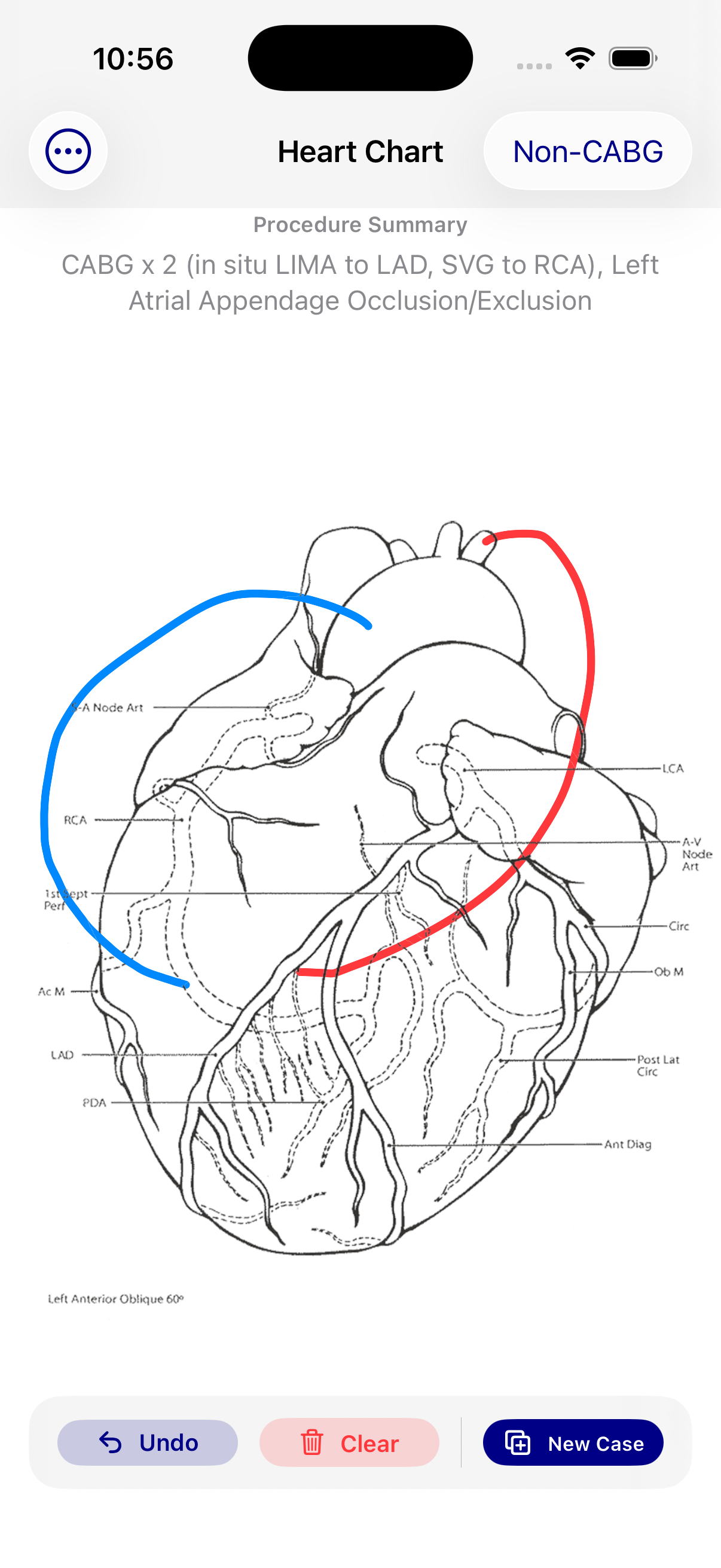 HeartChart app screenshot showing case details and sharing workflow